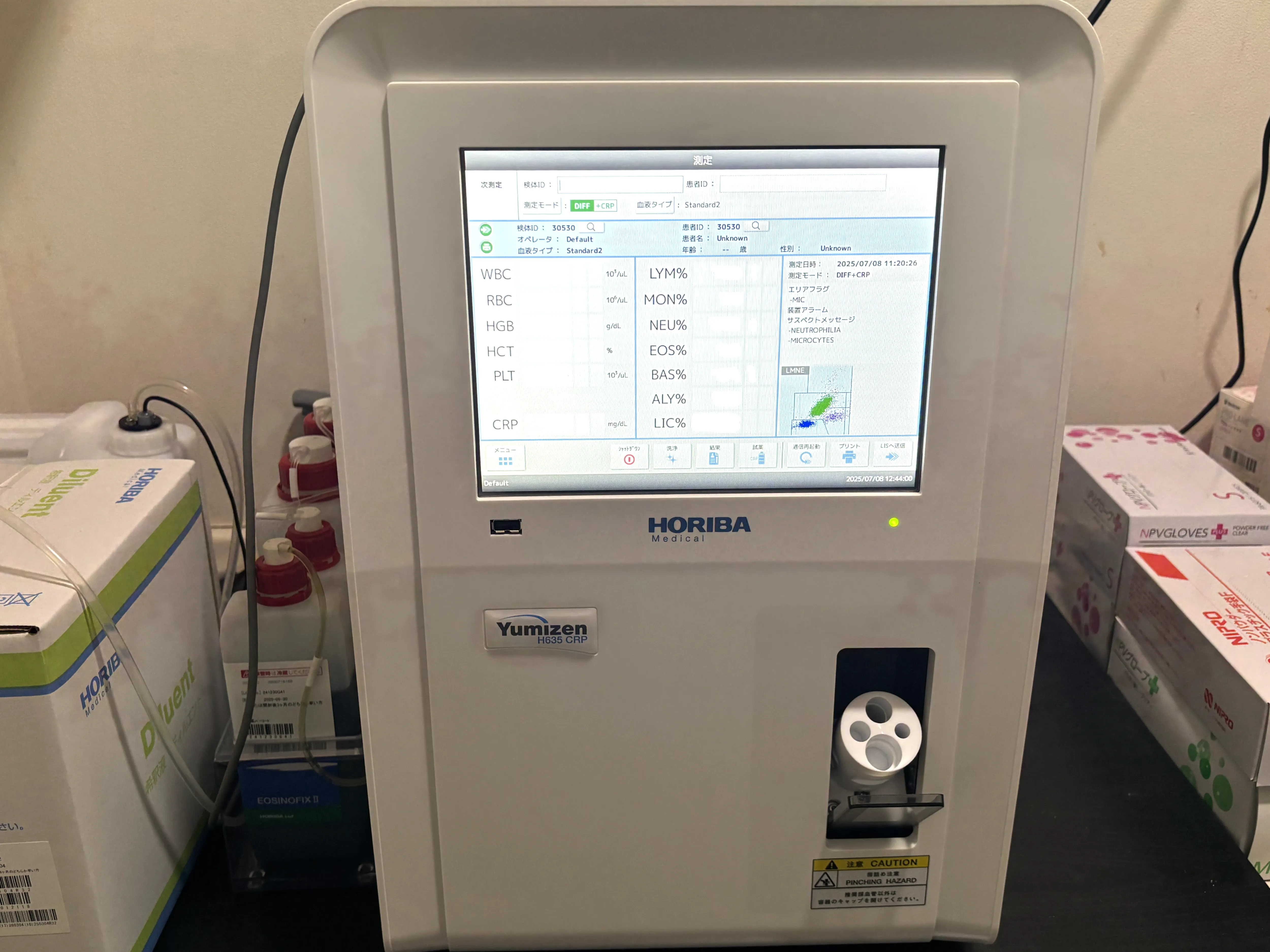 自動血球計数装置